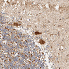 Immunohistochemical staining of human cerebellum shows strong cytoplasmic positivity in Purkinje cells.