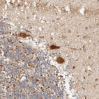 Immunohistochemical staining of human cerebellum shows strong cytoplasmic positivity in Purkinje cells.