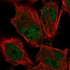 Immunofluorescent staining of human cell line U-251 MG shows localization to nucleoplasm & nucleoli.