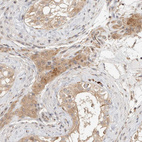 Anti-KIF9 Antibody