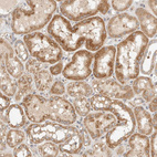Immunohistochemical staining of human kidney shows moderate cytoplasmic positivity in cells in tubules.