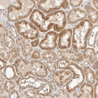 Immunohistochemical staining of human kidney shows moderate cytoplasmic positivity in cells in tubules.
