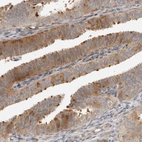 Immunohistochemical staining of human fallopian tube shows moderate cytoplasmic positivity in glandular cells.