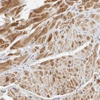 Immunohistochemical staining of human heart muscle shows moderate cytoplasmic positivity in cardiomyocytes.