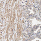 Immunohistochemical staining of human prostate shows weak to moderate cytoplasmic positivity in smooth muscle cells.