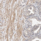 Immunohistochemical staining of human prostate shows weak to moderate cytoplasmic positivity in smooth muscle cells.