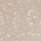 Immunohistochemical staining of human cerebral cortex shows weak cytoplasmic positivity in neuropil.