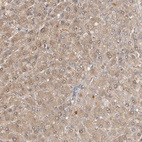 Immunohistochemical staining of human liver shows moderate cytoplasmic positivity in hepatocytes.