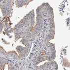 Immunohistochemical staining of human Fallopian tube shows moderate positivity in apical membrane in glandular cells.