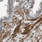 Immunohistochemical staining of human prostate shows strong nuclear positivity in smooth muscle cells.