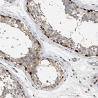 Immunohistochemical staining of human testis shows strong nuclear positivity in a subset of cells in seminiferous ducts.