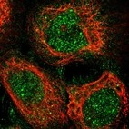 Immunofluorescent staining of human cell line A-431 shows localization to nucleoplasm, nuclear bodies, plasma membrane & cytosol.