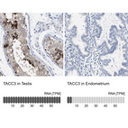 Anti-TACC3 Antibody