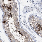 Immunohistochemical staining of human testis shows high expression.
