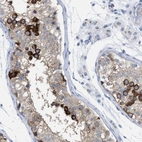 Immunohistochemical staining of human testis shows high expression.