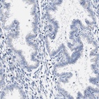 Immunohistochemical staining of human endometrium shows low expression as expected.
