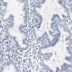 Immunohistochemical staining of human endometrium shows low expression as expected.
