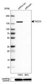 Western blot analysis in HEK293 cells transfected with control siRNA, target specific siRNA probe #1, using Anti-TACC3 antibody. Remaining relative intensity is presented. Loading control: Anti-GAPDH.