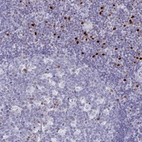 Immunohistochemical staining of human Tonsil shows strong nuclear positivity in lymphoid cells.