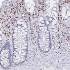 Immunohistochemical staining of human Rectum shows moderate nuclear positivity in lymphoid cells.