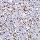 Immunohistochemical staining of human Salivary gland shows moderate nuclear and cytoplasmic positivity in ductal cells.