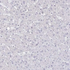 Immunohistochemical staining of human Liver shows no positivity as expected.