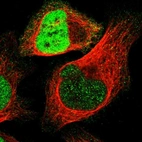 Immunofluorescent staining of human cell line U-2 OS shows localization to nucleoplasm.