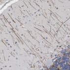 Immunohistochemical staining of human cerebellum shows moderate positivity in neuronal processes in cells in molecular layer.