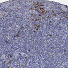 Immunohistochemical staining of human tonsil shows moderate cytoplasmic positivity in a subset of non-germinal center cells.