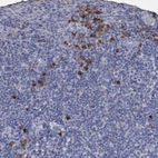 Immunohistochemical staining of human tonsil shows moderate cytoplasmic positivity in a subset of non-germinal center cells.