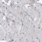Immunohistochemical staining of human skeletal muscle shows no positivity in myocytes as expected.
