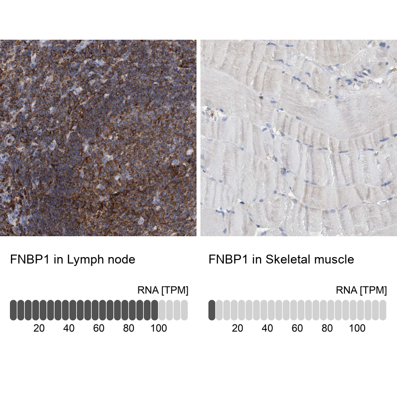 Anti-FNBP1 Antibody