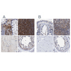 Immunohistochemical staining of human colon, lymph node, skeletal muscle and testis using Anti-FNBP1 antibody HPA022119 (A) shows similar protein distribution across tissues to independent antibody HPA019635 (B).