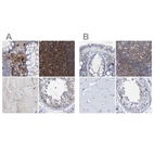 Immunohistochemical staining of human colon, lymph node, skeletal muscle and testis using Anti-FNBP1 antibody HPA022119 (A) shows similar protein distribution across tissues to independent antibody HPA019635 (B).