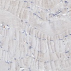 Immunohistochemical staining of human skeletal muscle shows low expression as expected.