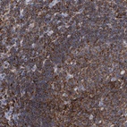 Immunohistochemical staining of human lymph node shows high expression.