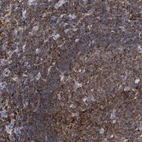 Immunohistochemical staining of human lymph node shows high expression.