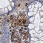 Immunohistochemical staining of human colon using Anti-FNBP1 antibody HPA022119.