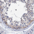 Immunohistochemical staining of human testis using Anti-FNBP1 antibody HPA022119.