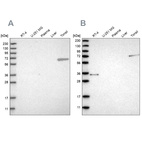 Western blot analysis using Anti-FNBP1 antibody HPA022119 (A) shows similar pattern to independent antibody HPA019691 (B).