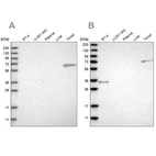 Western blot analysis using Anti-FNBP1 antibody HPA022119 (A) shows similar pattern to independent antibody HPA019691 (B).