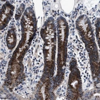 Immunohistochemical staining of human colon shows strong granular cytoplasmic positivity in glandular cells.