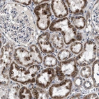 Immunohistochemical staining of human kidney shows strong granular cytoplasmic positivity in cells in tubules.