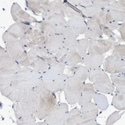 Immunohistochemical staining of human skeletal muscle shows no positivity in myocytes as expected.