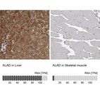 Anti-ALAD Antibody