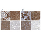 Immunohistochemical staining of human kidney, liver, pancreas and skeletal muscle using Anti-ALAD antibody HPA022124 (A) shows similar protein distribution across tissues to independent antibody HPA021023 (B).
