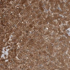 Immunohistochemical staining of human liver shows strong cytoplasmic positivity in hepatocytes.