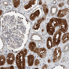 Immunohistochemical staining of human kidney shows strong cytoplasmic positivity in cells in tubules.