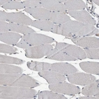 Immunohistochemical staining of human skeletal muscle shows no cytoplasmic positivity in myocytes as expected.