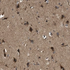 Anti-EGLN1 Antibody